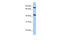 Potassium Two Pore Domain Channel Subfamily K Member 4 antibody, 26-484, ProSci, Western Blot image 