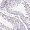 PHD Finger Protein 7 antibody, NBP2-49628, Novus Biologicals, Immunohistochemistry paraffin image 