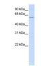 Neuropilin And Tolloid Like 2 antibody, NBP1-62591, Novus Biologicals, Western Blot image 