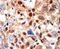 Promyelocytic Leukemia antibody, PA5-12185, Invitrogen Antibodies, Immunohistochemistry paraffin image 