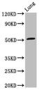 Rho GTPase Activating Protein 1 antibody, CSB-PA691829LA01HU, Cusabio, Western Blot image 