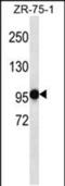 PHD Finger Protein 14 antibody, PA5-48502, Invitrogen Antibodies, Western Blot image 