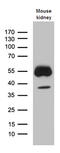 Kruppel Like Factor 7 antibody, M06749, Boster Biological Technology, Western Blot image 