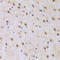Interleukin Enhancer Binding Factor 2 antibody, LS-C334359, Lifespan Biosciences, Immunohistochemistry paraffin image 