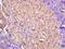 Cysteine Rich Protein 2 antibody, orb182744, Biorbyt, Immunohistochemistry paraffin image 