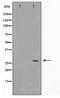 SIX Homeobox 6 antibody, TA347758, Origene, Western Blot image 