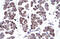 T-Box 20 antibody, ARP33177_P050, Aviva Systems Biology, Immunohistochemistry paraffin image 