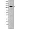 ADAM Metallopeptidase With Thrombospondin Type 1 Motif 2 antibody, abx147992, Abbexa, Western Blot image 