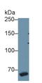 Coagulation Factor VIII antibody, LS-C302574, Lifespan Biosciences, Western Blot image 