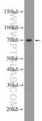 Heterogeneous Nuclear Ribonucleoprotein L antibody, 18354-1-AP, Proteintech Group, Western Blot image 