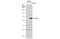E2F-1 antibody, GTX101235, GeneTex, Western Blot image 