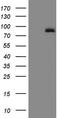 Arachidonate 5-Lipoxygenase antibody, LS-C793985, Lifespan Biosciences, Western Blot image 