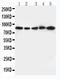 Integrin Subunit Beta 2 antibody, PA1623, Boster Biological Technology, Western Blot image 