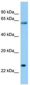 Signal Peptidase Complex Subunit 3 antibody, TA333715, Origene, Western Blot image 