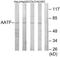 Apoptosis Antagonizing Transcription Factor antibody, TA312747, Origene, Western Blot image 