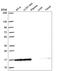 Nuclear Cap Binding Protein Subunit 2 antibody, HPA062483, Atlas Antibodies, Western Blot image 
