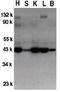 GDNF Family Receptor Alpha 3 antibody, GTX31634, GeneTex, Western Blot image 