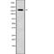 ATP Binding Cassette Subfamily C Member 6 antibody, abx147869, Abbexa, Western Blot image 