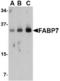 Fatty acid-binding protein, brain antibody, TA306442, Origene, Western Blot image 