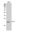 Bone Marrow Stromal Cell Antigen 2 antibody, STJ97307, St John