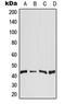 Diacylglycerol O-Acyltransferase 2 antibody, orb215325, Biorbyt, Western Blot image 