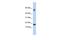 Testis Expressed 19 antibody, GTX45134, GeneTex, Western Blot image 