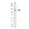 EPH Receptor A1 antibody, PA5-47837, Invitrogen Antibodies, Western Blot image 