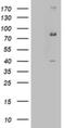 Enoyl-CoA Hydratase And 3-Hydroxyacyl CoA Dehydrogenase antibody, NBP2-46487, Novus Biologicals, Western Blot image 