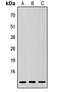 Small Ubiquitin Like Modifier 3 antibody, LS-C358346, Lifespan Biosciences, Western Blot image 