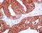 Autophagy Related 5 antibody, ab108327, Abcam, Immunohistochemistry paraffin image 