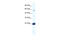 DEAD-Box Helicase 55 antibody, 28-500, ProSci, Western Blot image 