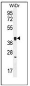 Olfactory Receptor Family 2 Subfamily T Member 8 antibody, AP53042PU-N, Origene, Western Blot image 