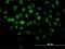 Histone Deacetylase 8 antibody, H00055869-M01, Novus Biologicals, Immunocytochemistry image 