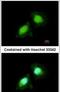 Aminoacyl TRNA Synthetase Complex Interacting Multifunctional Protein 2 antibody, PA5-31306, Invitrogen Antibodies, Immunofluorescence image 