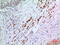 Interferon Alpha And Beta Receptor Subunit 2 antibody, STJ96732, St John