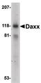 Death Domain Associated Protein antibody, LS-C276, Lifespan Biosciences, Western Blot image 