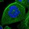 Keratin 13 antibody, NBP1-81648, Novus Biologicals, Immunofluorescence image 