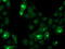 Cystatin-S antibody, M07438, Boster Biological Technology, Western Blot image 