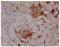 Endoglin antibody, GTX53121, GeneTex, Immunohistochemistry paraffin image 