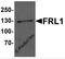 Formin-like protein 1 antibody, 7101, ProSci, Western Blot image 