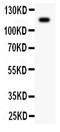 Complement C5 antibody, PB9187, Boster Biological Technology, Western Blot image 