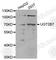 UDP Glucuronosyltransferase Family 2 Member B7 antibody, A1693, ABclonal Technology, Western Blot image 