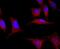 GLI Family Zinc Finger 1 antibody, NBP2-66867, Novus Biologicals, Immunocytochemistry image 