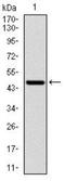 Ribosomal Protein S6 Kinase B1 antibody, NBP2-22205, Novus Biologicals, Western Blot image 