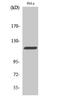 Cbl Proto-Oncogene antibody, A00152, Boster Biological Technology, Western Blot image 