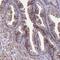 Complement C6 antibody, PA5-60527, Invitrogen Antibodies, Immunohistochemistry paraffin image 