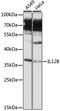 Interleukin 12B antibody, LS-C748087, Lifespan Biosciences, Western Blot image 