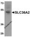 Solute Carrier Family 36 Member 2 antibody, 8341, ProSci, Western Blot image 