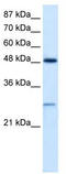 Chloride Intracellular Channel 4 antibody, TA338569, Origene, Western Blot image 