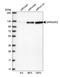 G Protein-Coupled Receptor Associated Sorting Protein 2 antibody, HPA017438, Atlas Antibodies, Western Blot image 